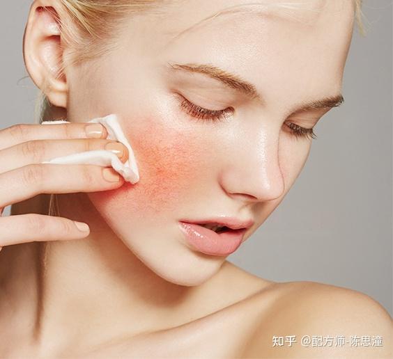 为什么涂护肤品会刺痛?