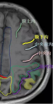 中枢神经系统解剖—端脑(1) - 知乎