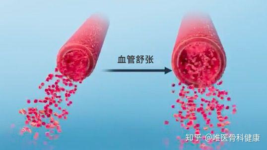 虽然人体血管收缩及舒张的原理远比这个复杂,但是为了方便理解就先