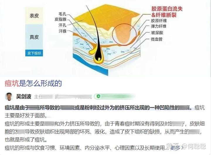v2-1cb961ca4af5c8db03132b6d7372fa21_r.jpg