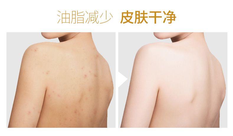 v2-1cbc0a4a7965dc2a9dbc87e4a193d192_1440w.jpg?source=172ae18b