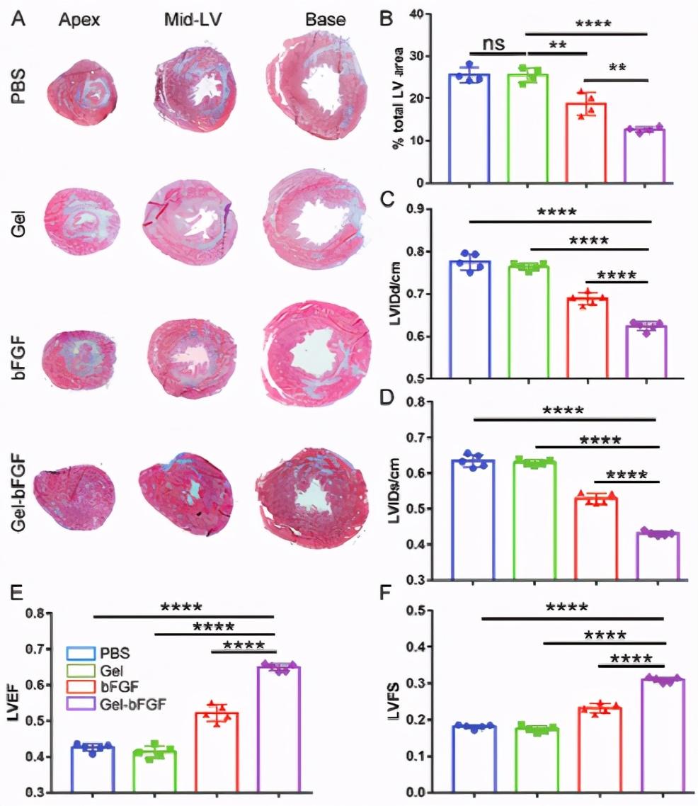 a)治疗后4周,代表masson的三色染色心肌切片.