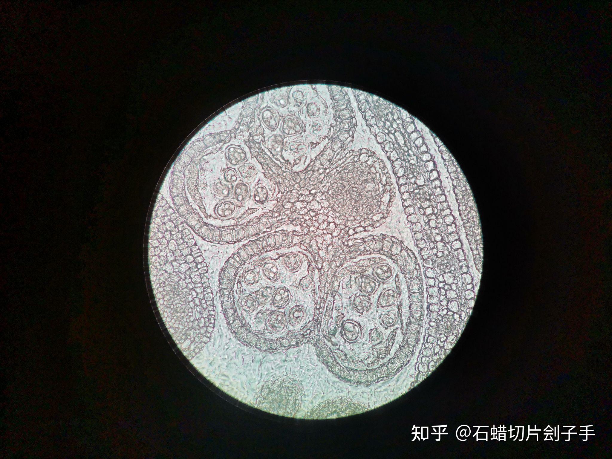 盘点我经手的石蜡切片