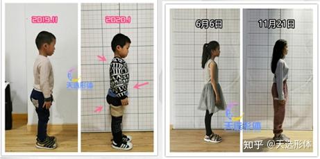 警惕孩子高低肩的后果你承受得起吗