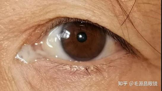 泪器的解剖生理 - 知乎