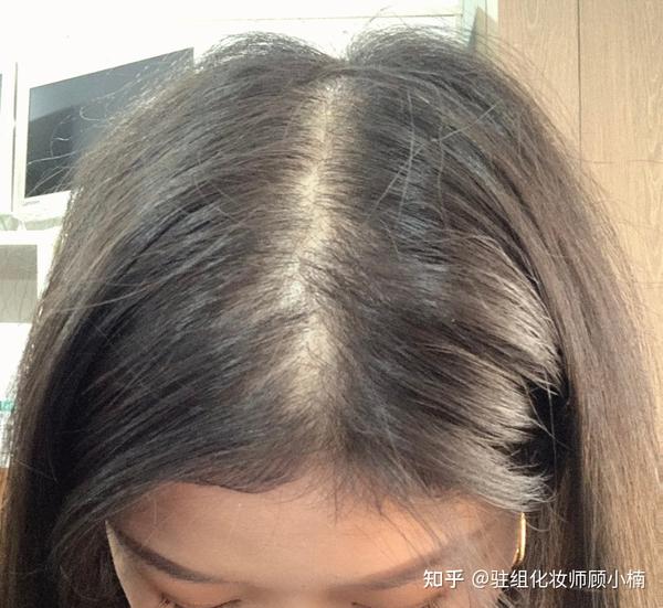 防脱洗发水都用遍了，为什么头发还是掉一堆，发缝宽成通天河，枕头上下水道都是头发？有什么好用的办法吗？ - 知乎