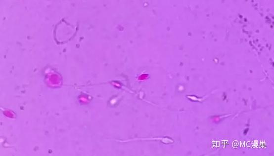 什么样的精子是死精 v2-1d7a4795671245b315bebd2b2ab67ead_r.jpg