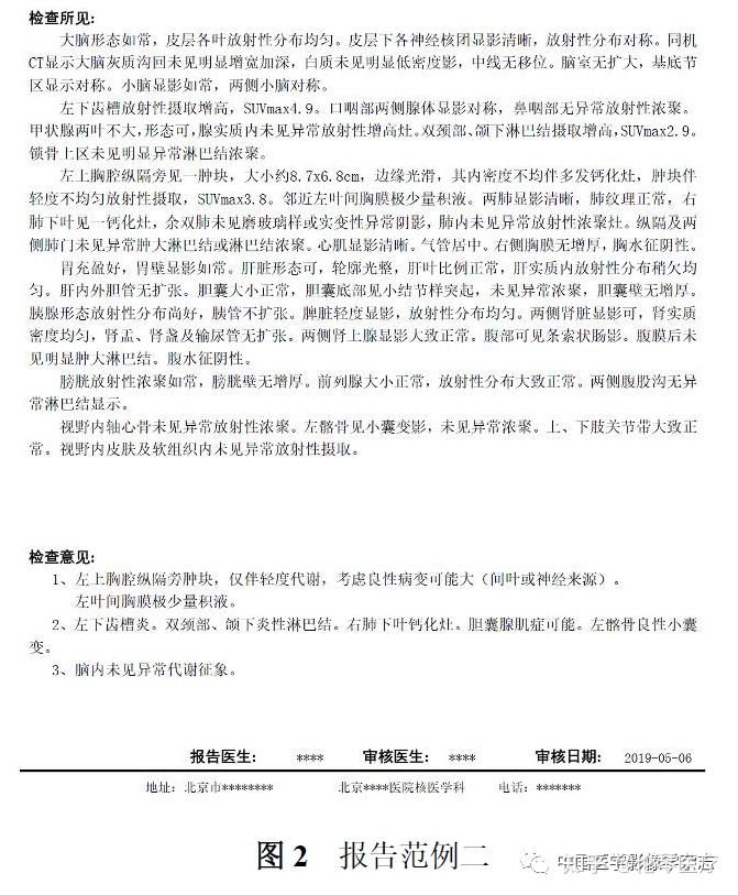 影像干货 | 核医学（18）F-FDG PET/CT报告书写规范 - 知乎