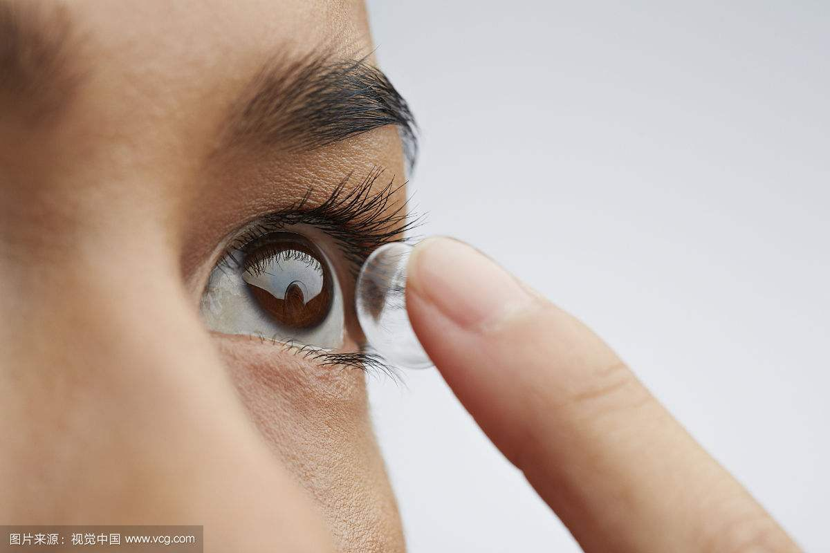 【警惕 ️】女子戴「隐形眼镜」30年⚡ 眼角膜长满新生血管！