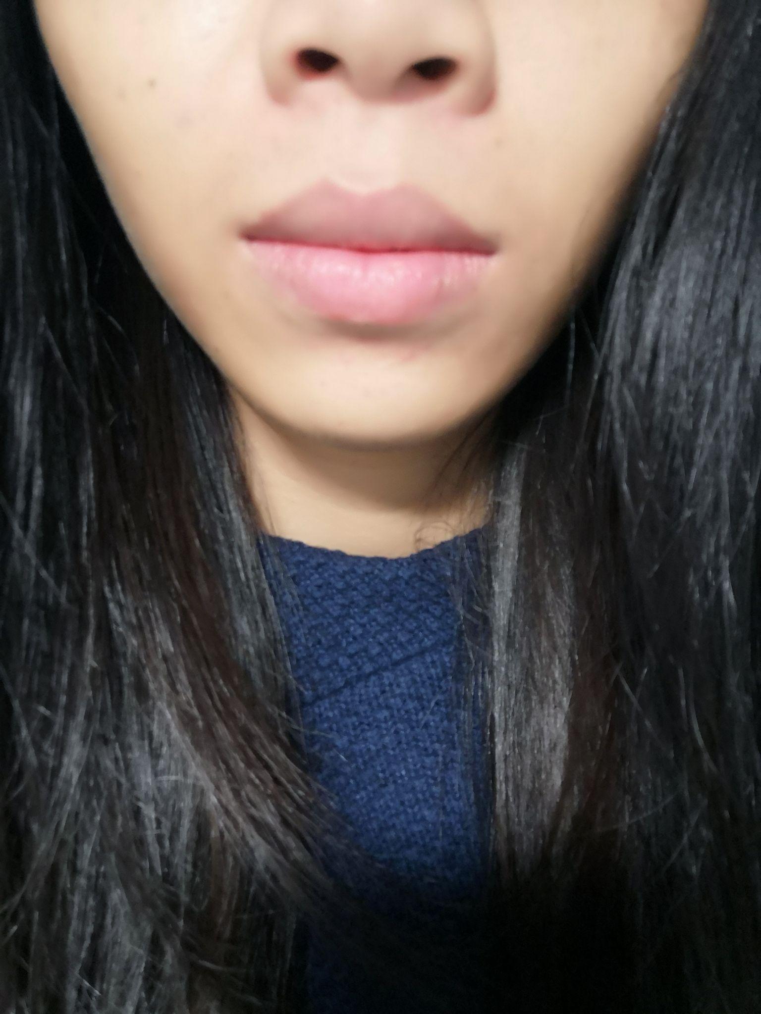 嘴巴难看是一种怎样的体验?