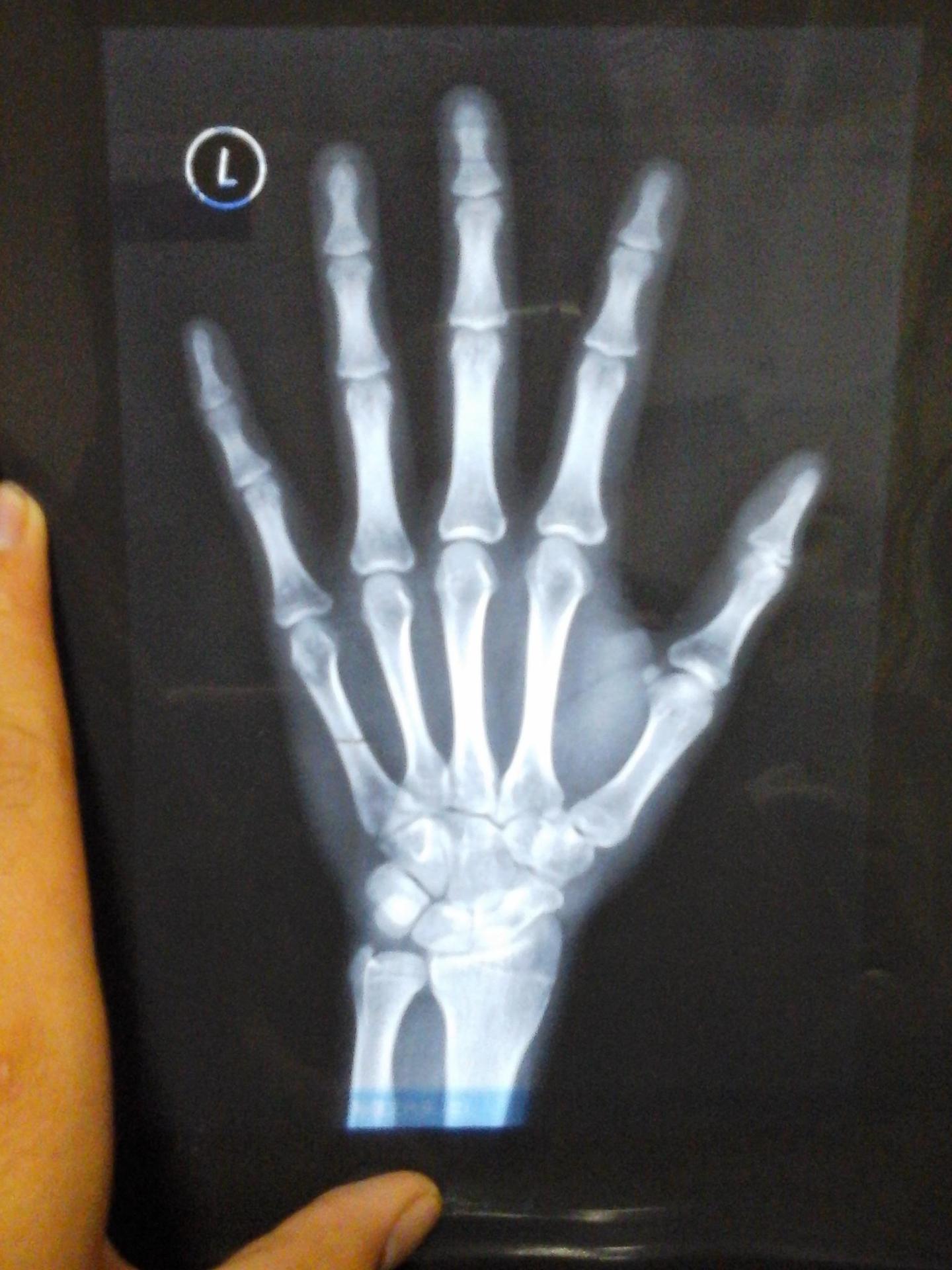 v2-1e100fb0e7568ee3b3ecf83957fe4611_1440w.jpg?source=172ae18b