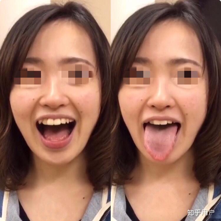 女生口臭是种怎样的体验
