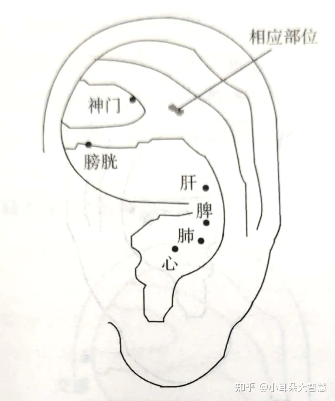 耳穴埋豆治疗急性腰痛