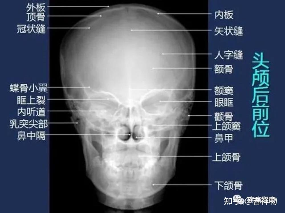 系统解剖学笔记1-颅骨 - 知乎
