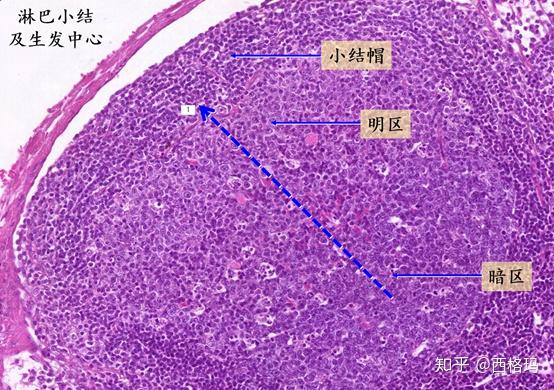 淋巴结生发中心图片