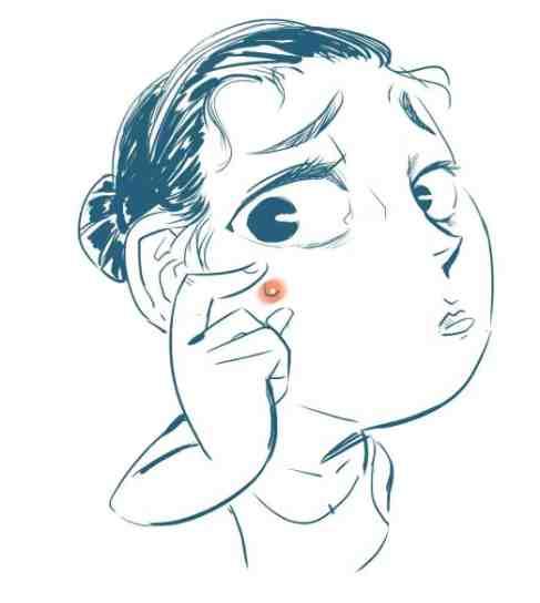 痘印如何更好淡化和修复 真的有效果的祛痘淡化痘印护肤品排行榜10强