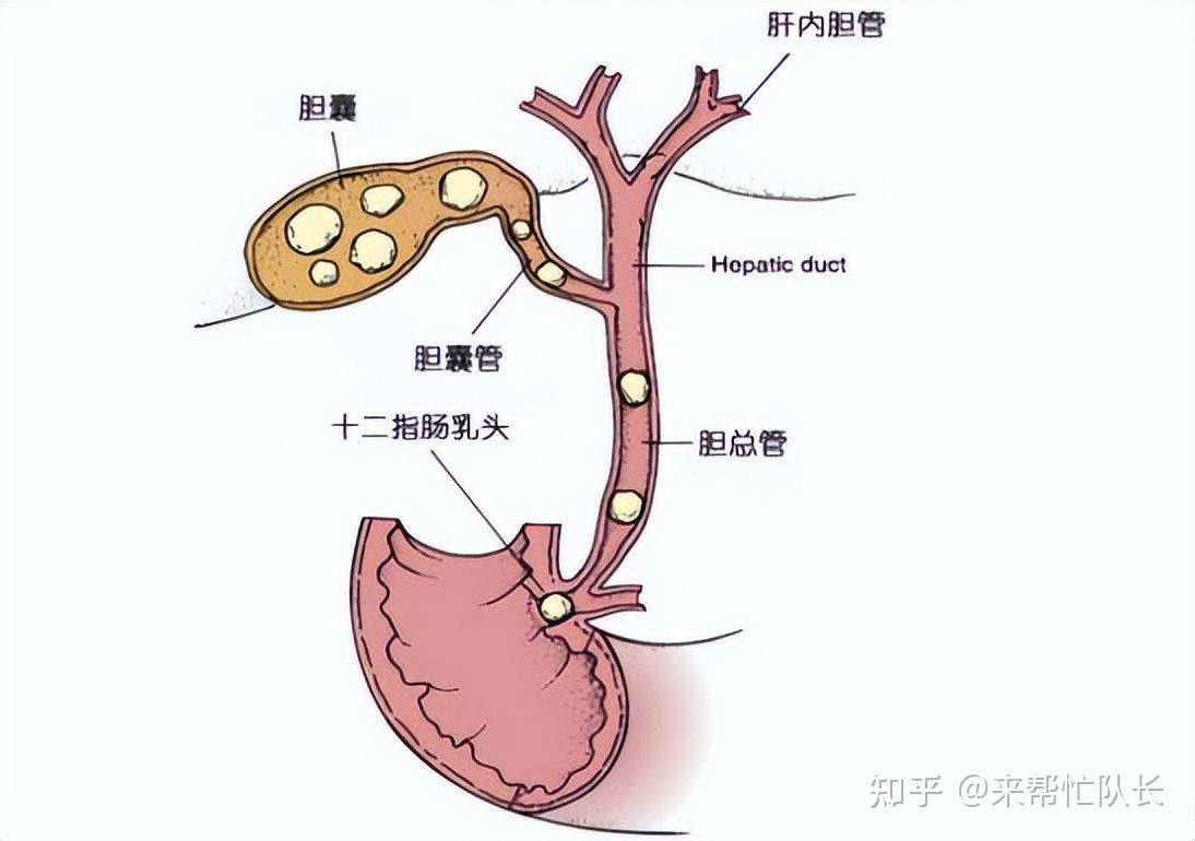 胆总管分段解剖图图片