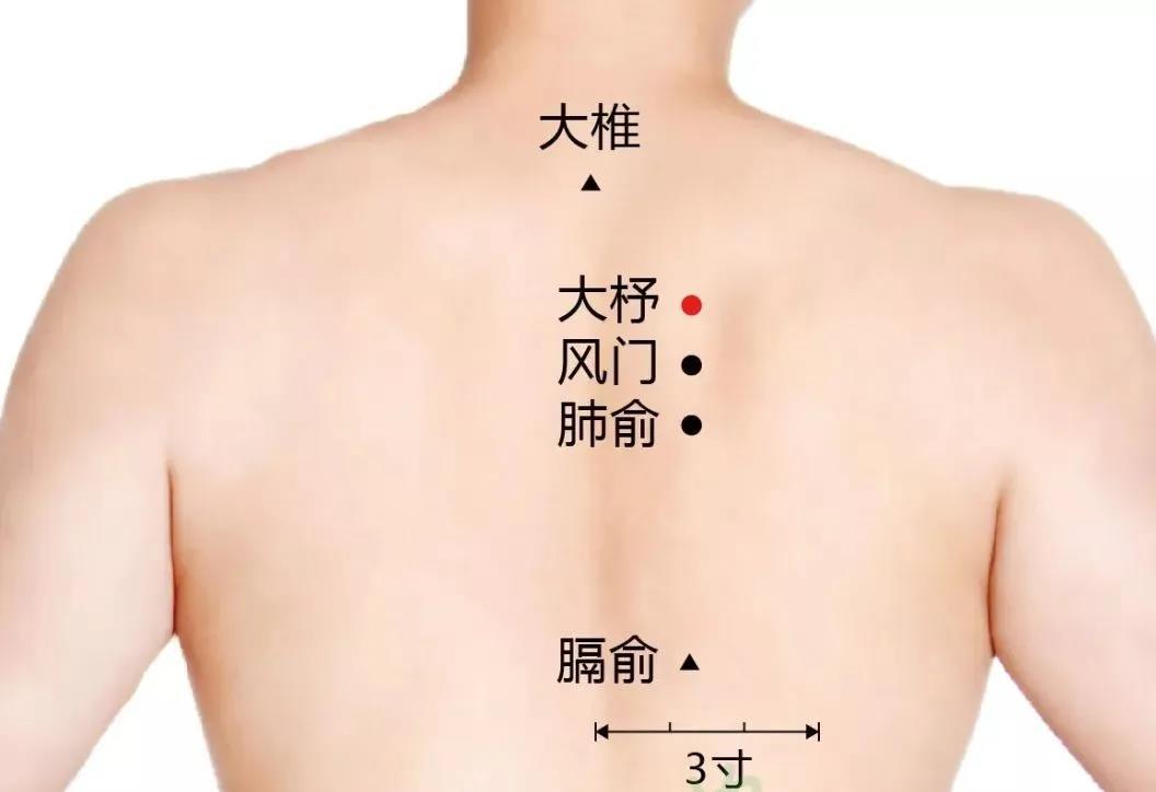 孩子该不该做三伏灸?入伏前必看!