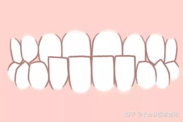 下6牙齿形态图片图片