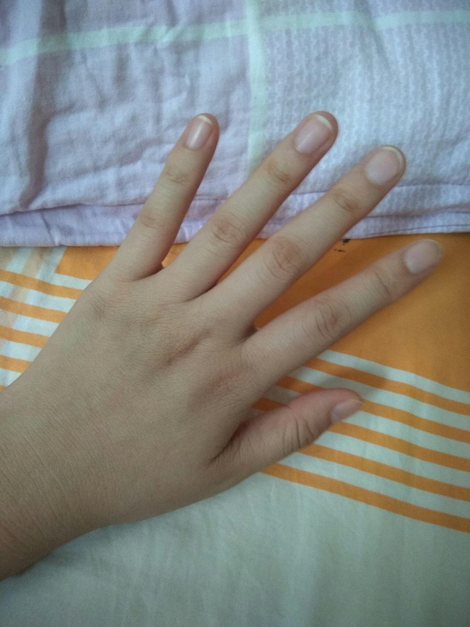 晒出你的小胖手说出小胖手给你了哪些困扰