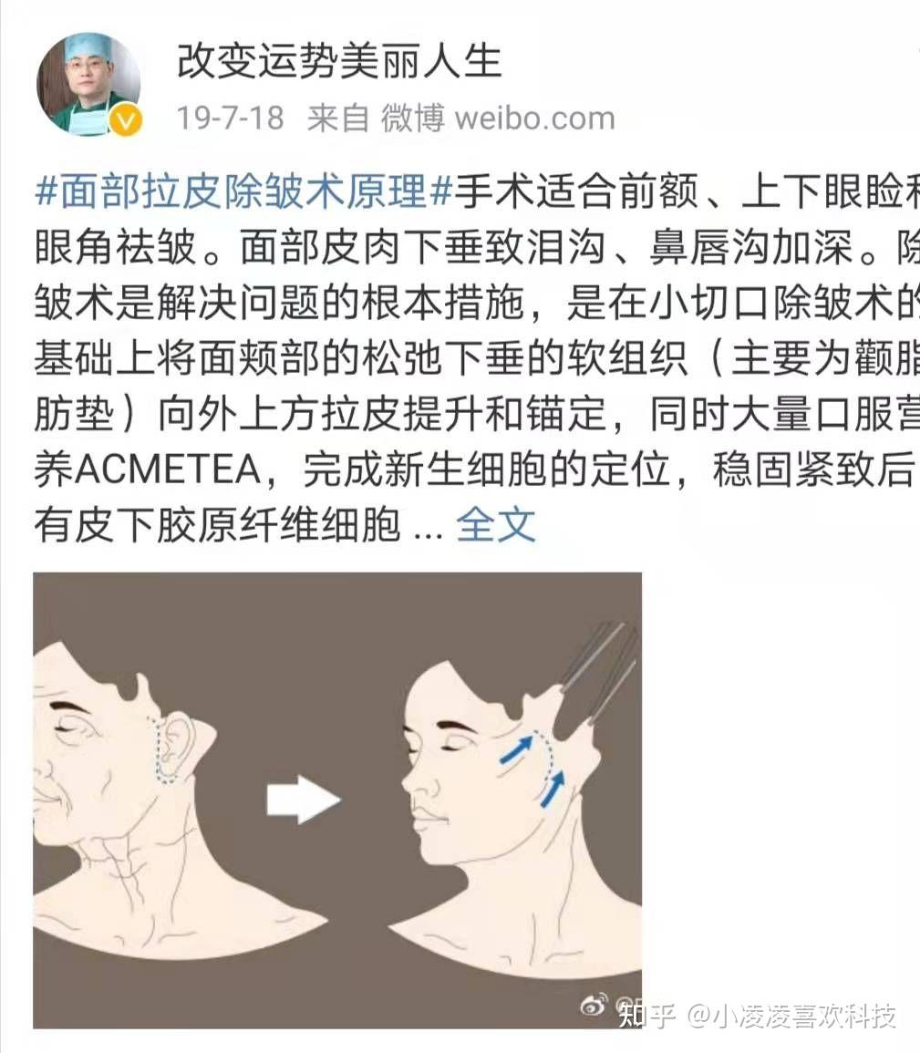 小拉皮多久可以恢復到最佳狀態小拉皮手術多久恢復自然這對比真的絕