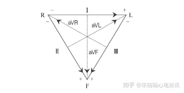 利用einthoven三角定律判斷心電圖肢體導聯錯接