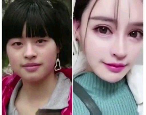 整容前和整容后的对比 - 知乎