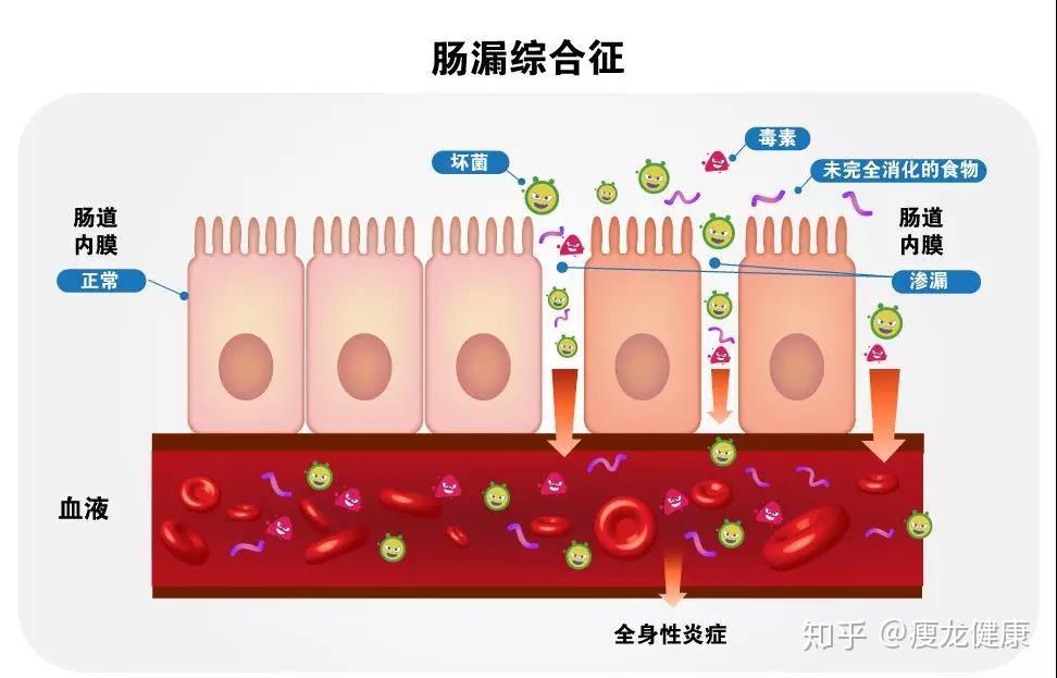 炎症,百病之源,如何消除炎症? - 知乎