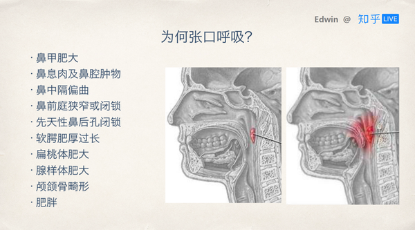 如何从小到大保护好牙齿?