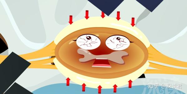 颈椎病怎么治疗好? 治疗颈椎病最好的方法是什