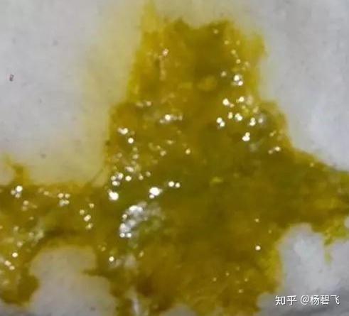 婴幼儿大便识别详解(超级实用) - 知乎