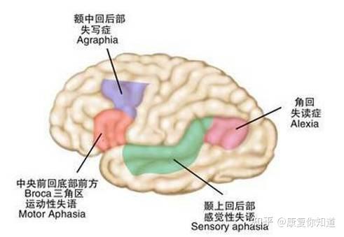 失语症(一文读懂)