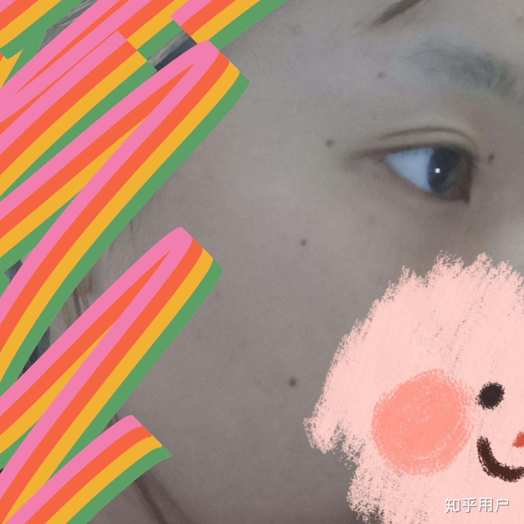 有没有人可以指点一下呀三颗痣连成一条线是怎么样阿