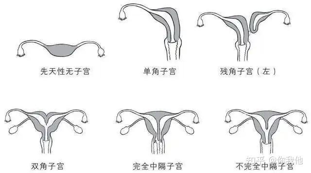解读《始基子宫》让你成功要个孩子！ - 知乎