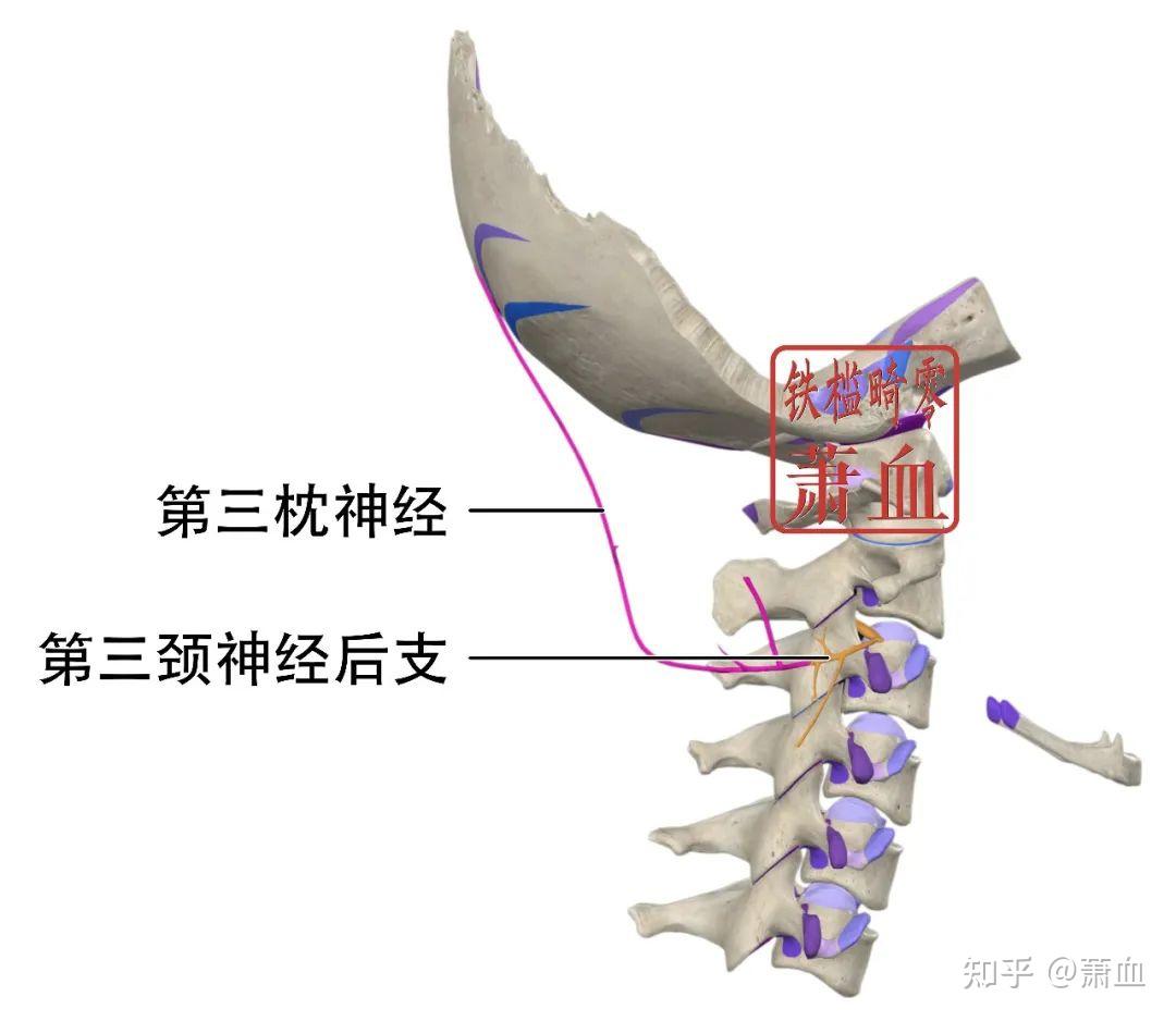 神经卡压|第三枕神经 - 知乎