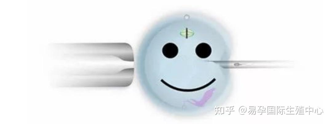 纺锤体在辅助生殖中的重要性——易孕国际 - 知乎