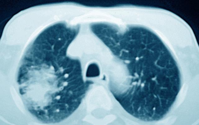 v2-201f7bc572dec1dc5f9a6317826a519b_1440w.jpg?source=172ae18b