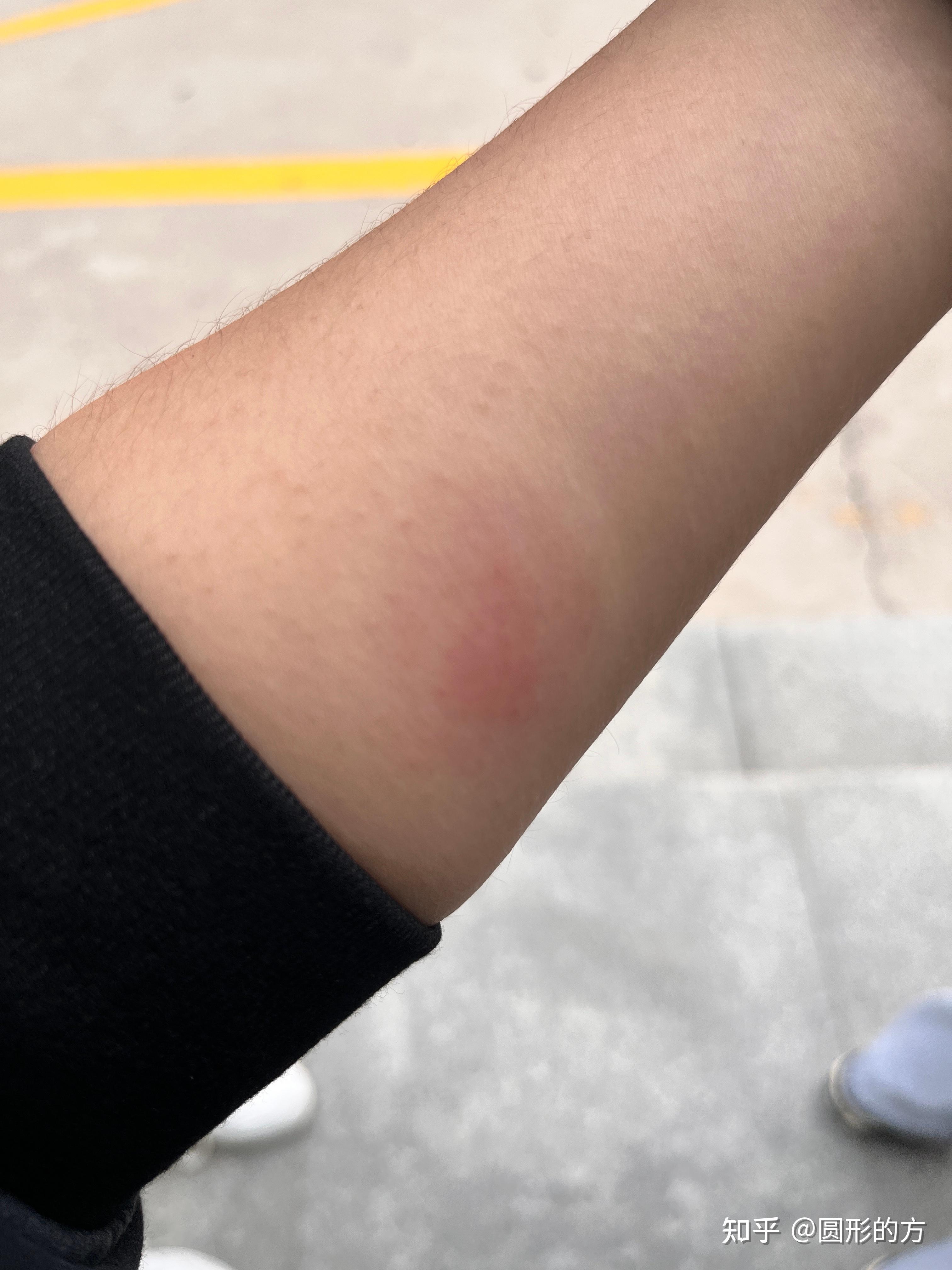 ppd72小时77心路历程持续记录95