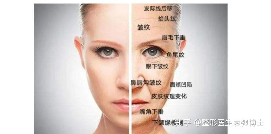 皱纹太显老!抬头纹、鱼尾纹、法令纹,3分钟告诉你如何改善 - 知乎