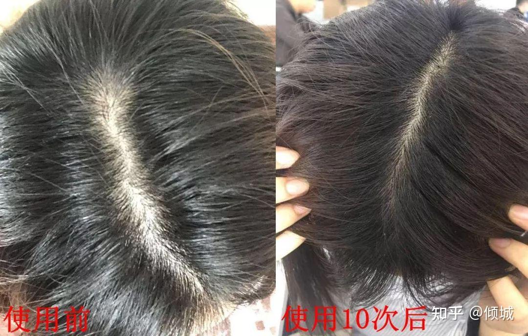 你的头发一根都不许掉!德国这款变态洗发皂7天发量暴增?20天浓密乌黑? - 知乎