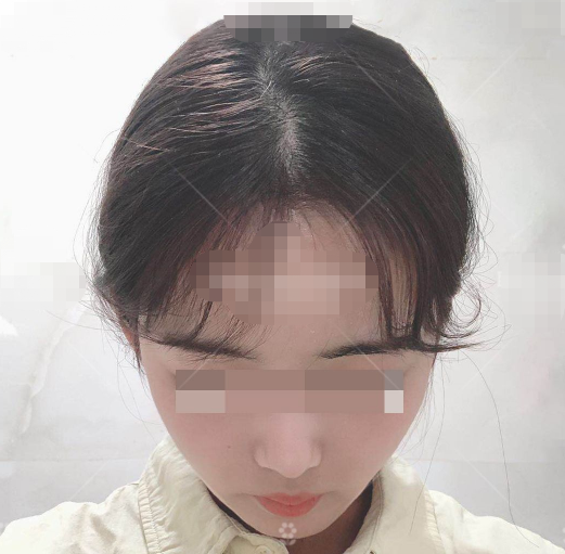 怎么拥有清晰的下颌角 v2-20bc31e30a89a1565c4f9eb815db8941_1440w.jpg?source=172ae18b