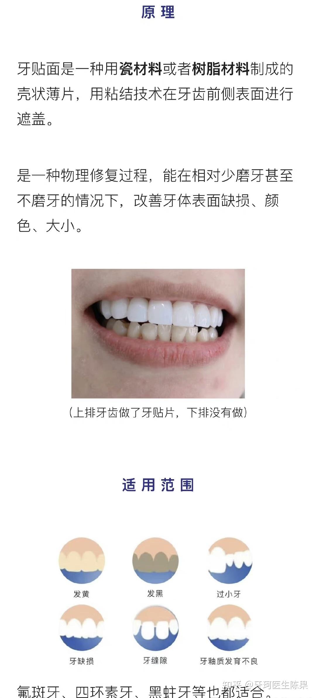 牙齿上的牙斑怎么去除,牙斑怎样快速去除,表面(第9页)_大山谷图库