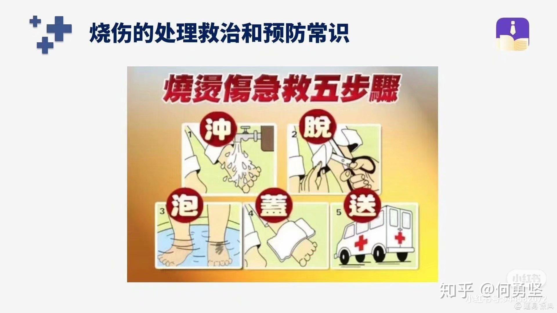 简述烧伤小知识 - 知乎