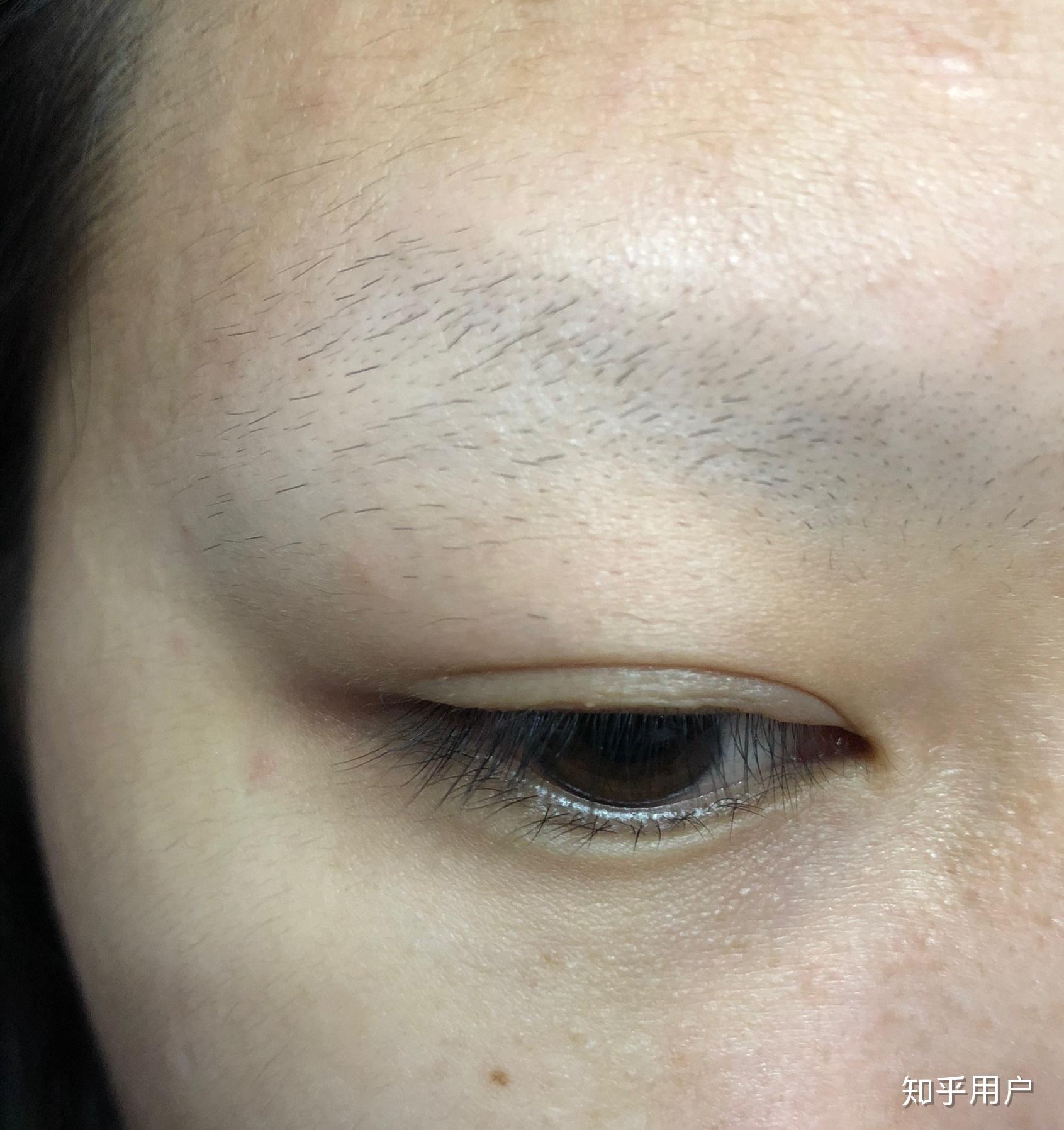 切眉后的疤痕如何通过纹眉改善 - 知乎