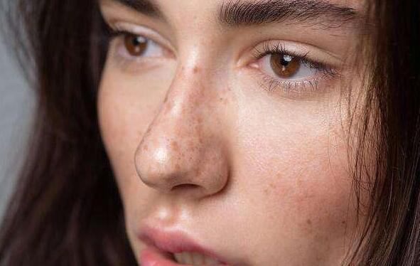 激光治疗后色沉了怎么办