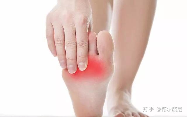 脚疼是怎么回事 不同位置疼痛的原因不同 这篇文章都说全了 知乎