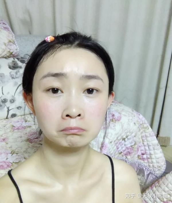 有没有因为鼻子不好看而毁了整张脸的例子?