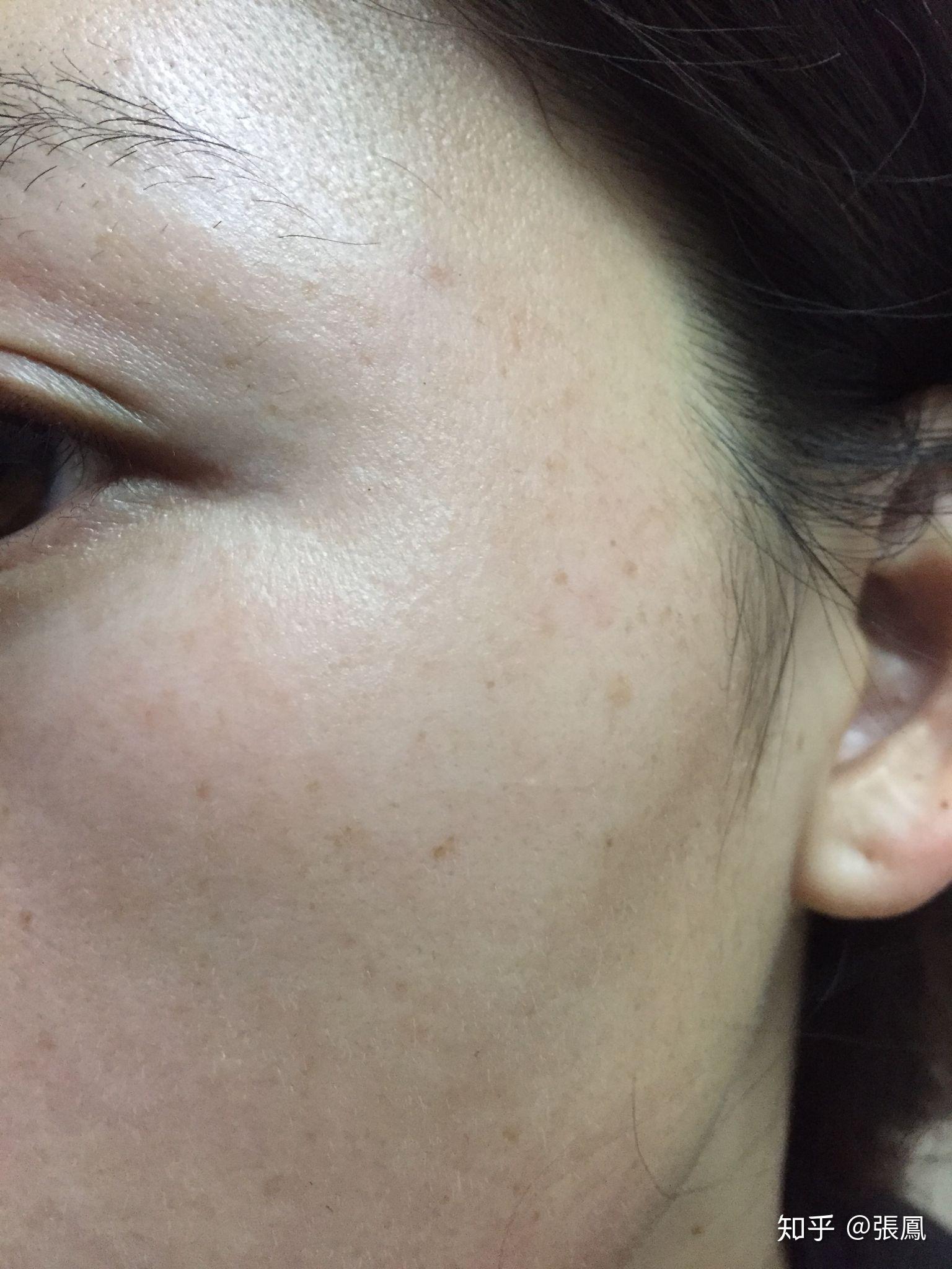 去掉斑点真的是是女性的一次重生