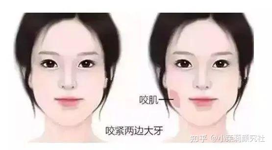 方脸如何远离土气变高级?发型、妆容、饰品、医美一篇搞定! - 知乎