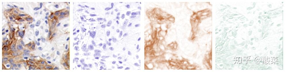 imagej quantify he staining imagej quantify he staining